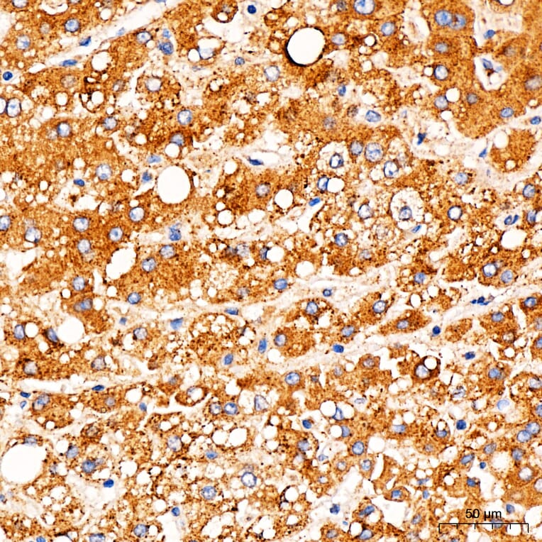 Immunohistochemistry - Anti-TOMM6 Antibody (A17062) - Antibodies.com