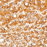 Immunohistochemistry - Anti-TOMM6 Antibody (A17062) - Antibodies.com
