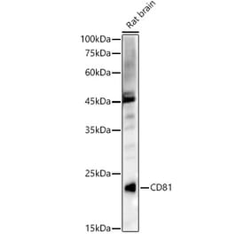 Western Blot - Anti-CD81 Antibody (A17063) - Antibodies.com