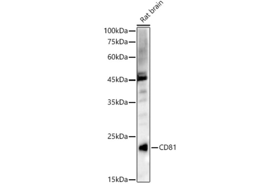Western Blot - Anti-CD81 Antibody (A17063) - Antibodies.com