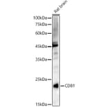 Western Blot - Anti-CD81 Antibody (A17063) - Antibodies.com