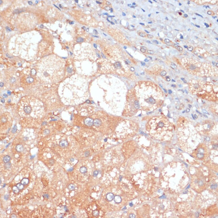 Immunohistochemistry - Anti-RIP3 Antibody (A17064) - Antibodies.com