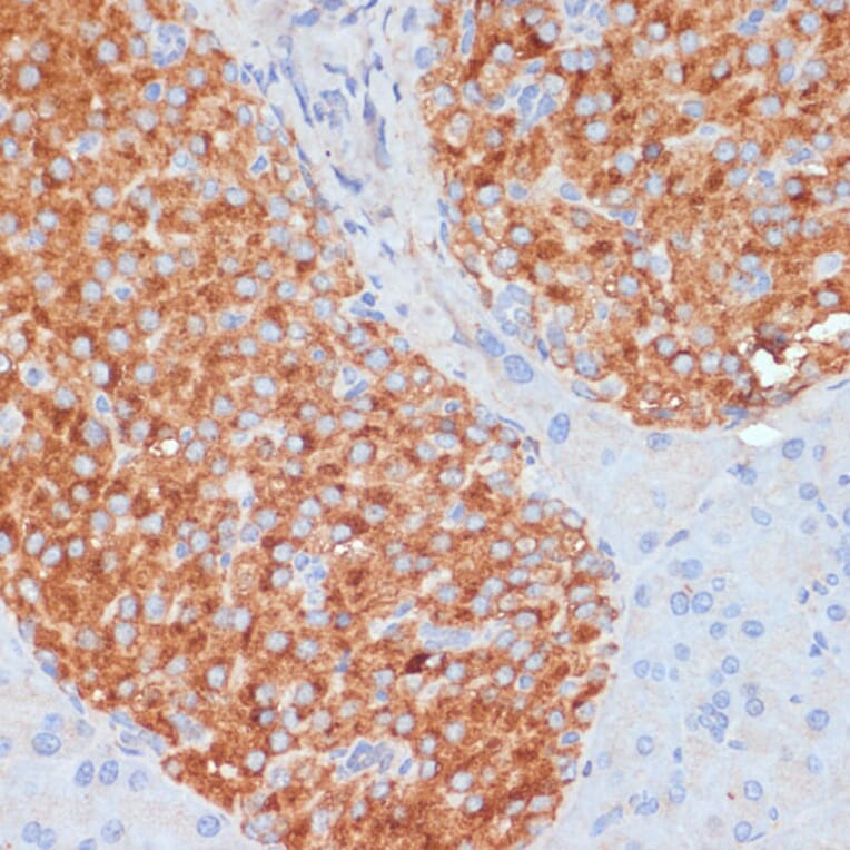 Immunohistochemistry - Anti-RIP3 Antibody (A17064) - Antibodies.com