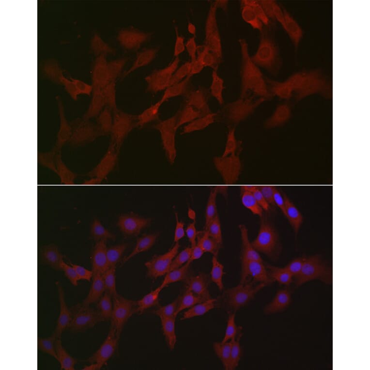 Immunofluorescence - Anti-RIP3 Antibody (A17064) - Antibodies.com