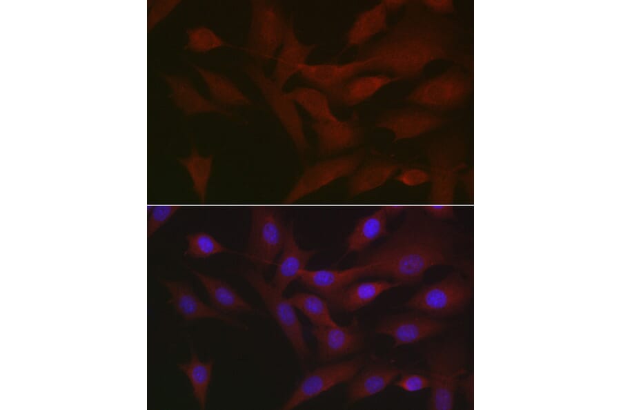 Immunofluorescence - Anti-RIP3 Antibody (A17064) - Antibodies.com