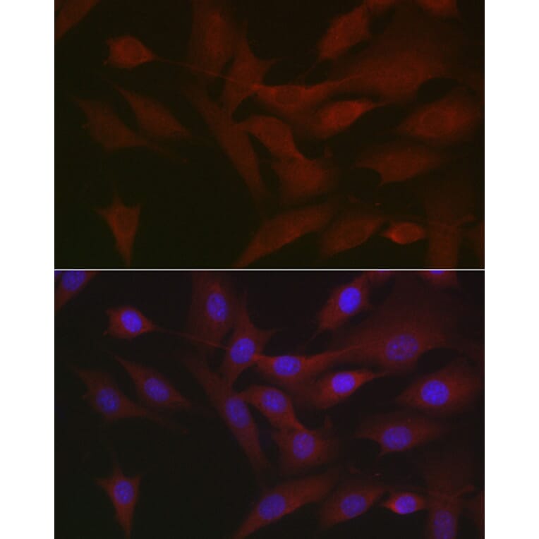 Immunofluorescence - Anti-RIP3 Antibody (A17064) - Antibodies.com