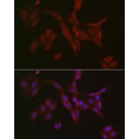 Immunofluorescence - Anti-RIP3 Antibody (A17064) - Antibodies.com
