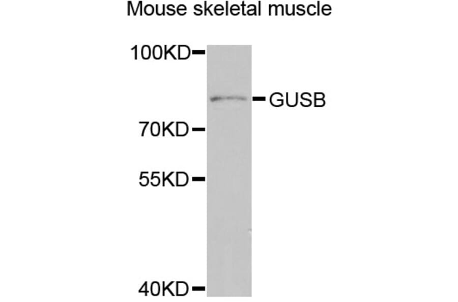 Western Blot - Anti-GUSB Antibody (A5813) - Antibodies.com