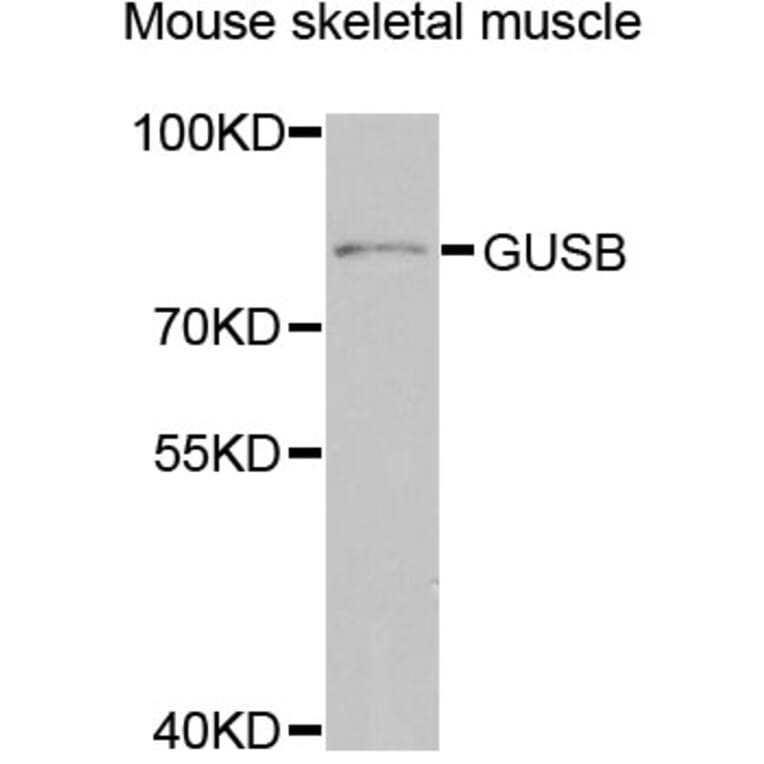 Western Blot - Anti-GUSB Antibody (A5813) - Antibodies.com