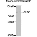 Western Blot - Anti-GUSB Antibody (A5813) - Antibodies.com