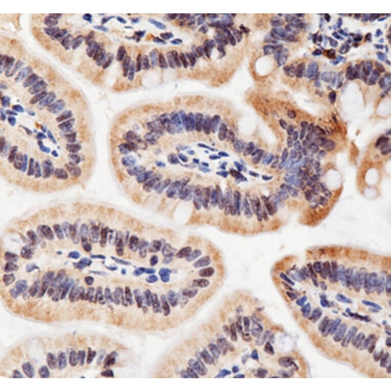 Immunohistochemistry - Anti-ACHE Antibody (A6161) - Antibodies.com