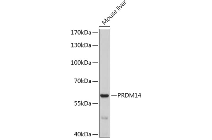 Western Blot - Anti-PRDM14 Antibody (A17067) - Antibodies.com