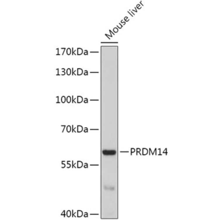Western Blot - Anti-PRDM14 Antibody (A17067) - Antibodies.com
