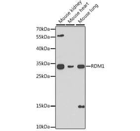 Western Blot - Anti-RDM1 Antibody (A17068) - Antibodies.com