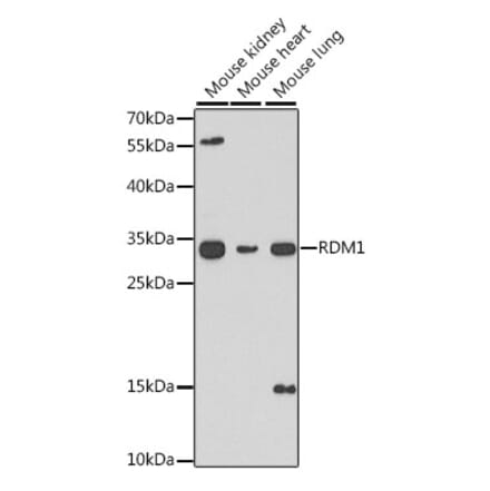 Western Blot - Anti-RDM1 Antibody (A17068) - Antibodies.com