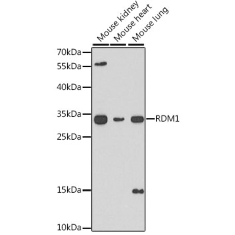 Western Blot - Anti-RDM1 Antibody (A17068) - Antibodies.com