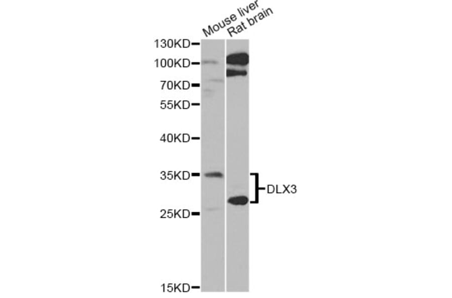 Western Blot - Anti-DLX3 Antibody (A6902) - Antibodies.com