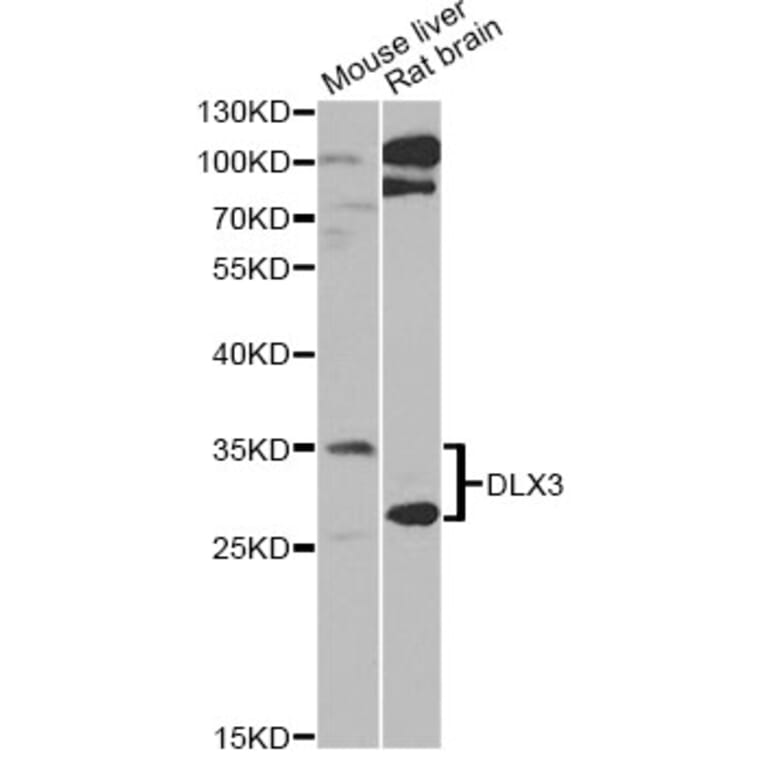 Western Blot - Anti-DLX3 Antibody (A6902) - Antibodies.com