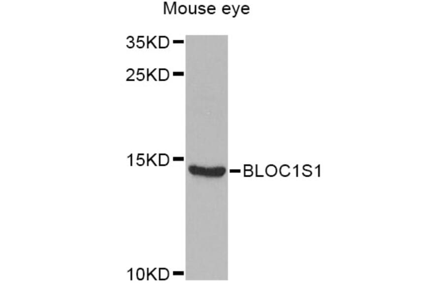 Western Blot - Anti-BLOC1S1 Antibody (A6912) - Antibodies.com