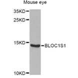 Western Blot - Anti-BLOC1S1 Antibody (A6912) - Antibodies.com