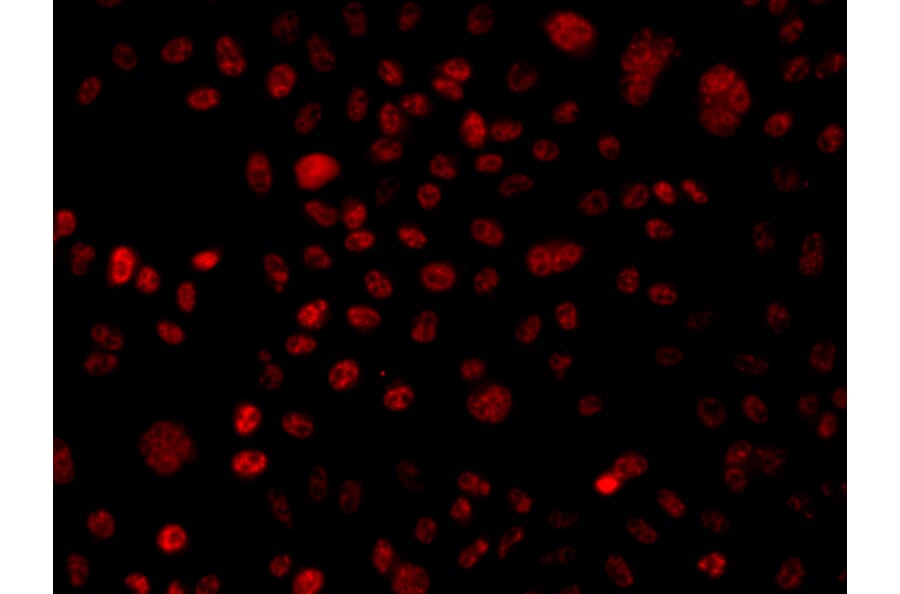 Immunofluorescence - Anti-BAF250 Antibody (A7607) - Antibodies.com