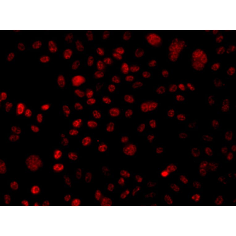 Immunofluorescence - Anti-BAF250 Antibody (A7607) - Antibodies.com