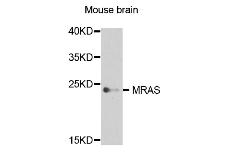 Western Blot - Anti-MRAS Antibody (A8315) - Antibodies.com