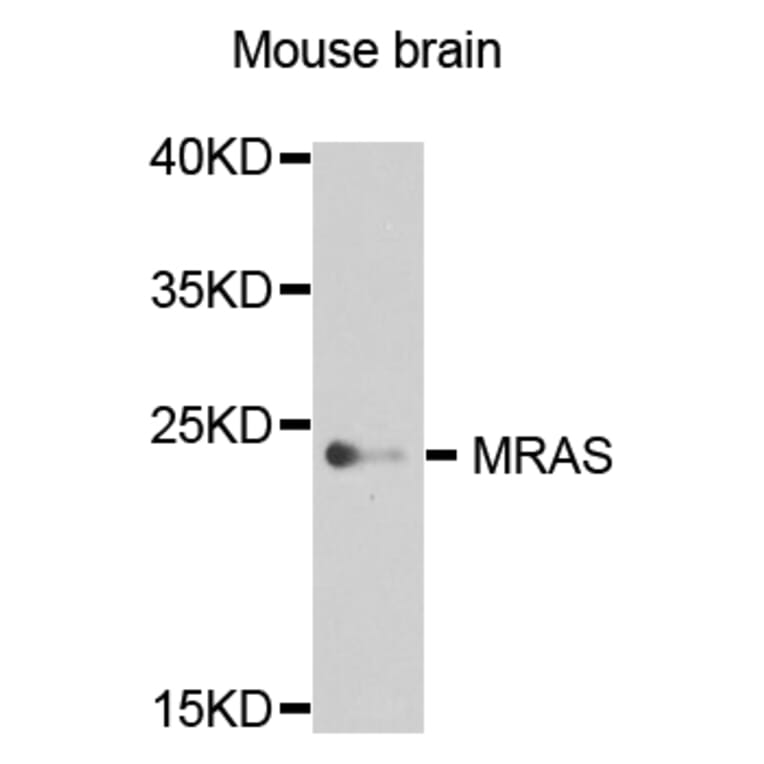 Western Blot - Anti-MRAS Antibody (A8315) - Antibodies.com