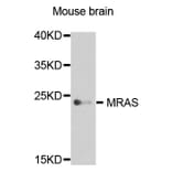 Western Blot - Anti-MRAS Antibody (A8315) - Antibodies.com