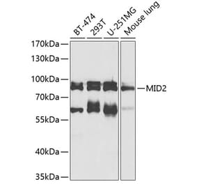 Western Blot - Anti-MID2 Antibody (A17075) - Antibodies.com