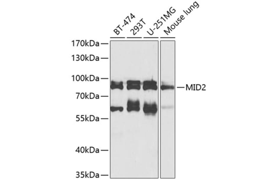 Western Blot - Anti-MID2 Antibody (A17075) - Antibodies.com