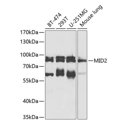 Western Blot - Anti-MID2 Antibody (A17075) - Antibodies.com