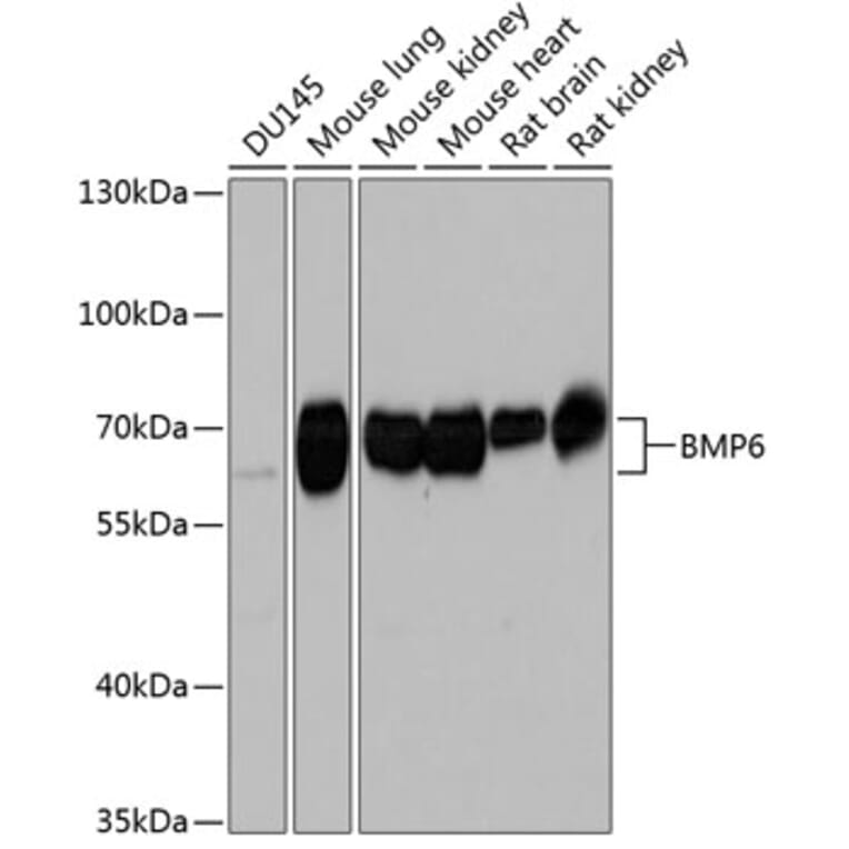 Western Blot - Anti-BMP6 Antibody (A17076) - Antibodies.com