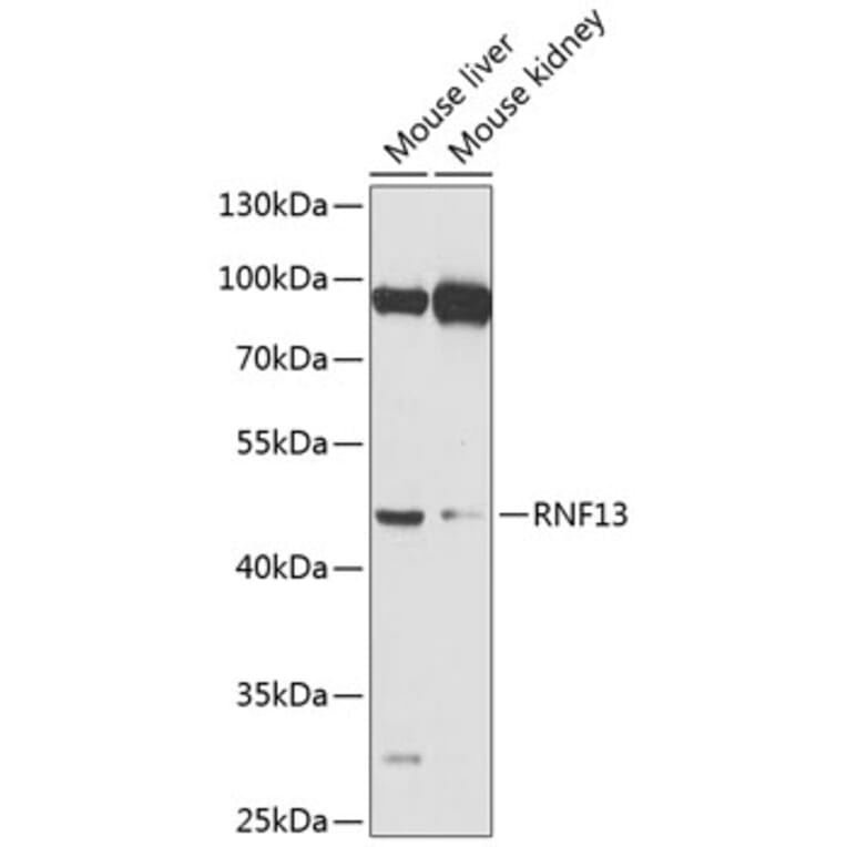 Western Blot - Anti-RNF13 Antibody (A17077) - Antibodies.com