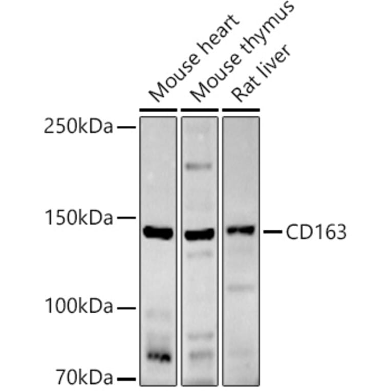 Western Blot - Anti-CD163 Antibody (A17078) - Antibodies.com
