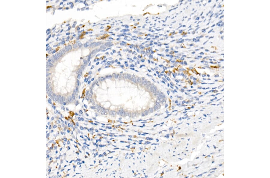 Immunohistochemistry - Anti-CD163 Antibody (A17078) - Antibodies.com