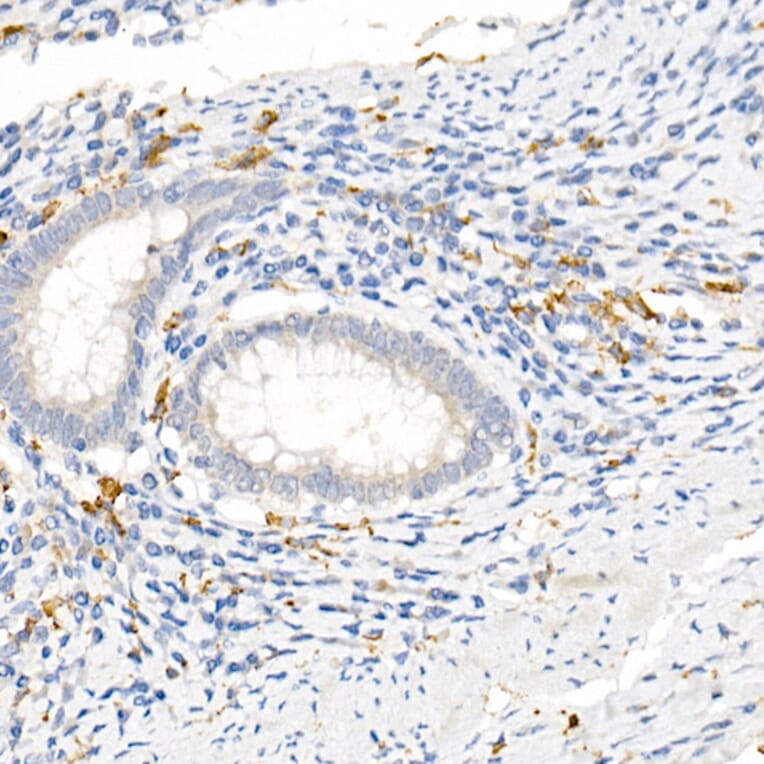 Immunohistochemistry - Anti-CD163 Antibody (A17078) - Antibodies.com