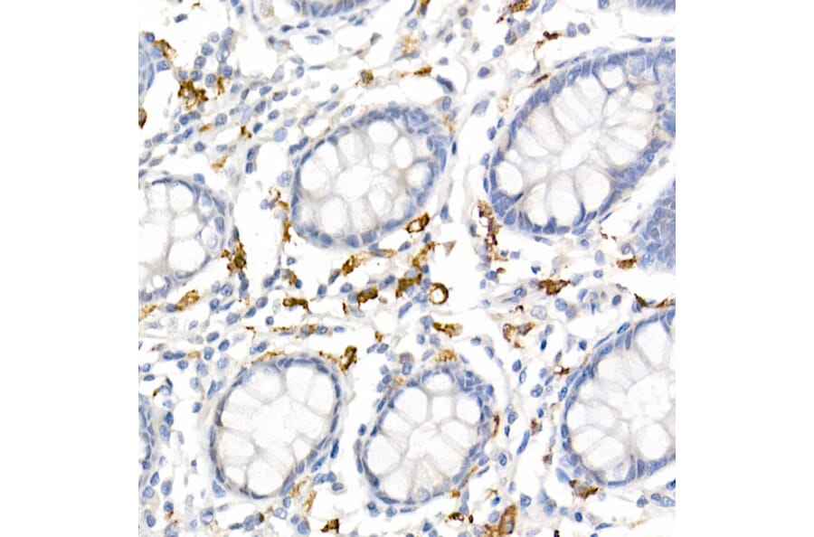 Immunohistochemistry - Anti-CD163 Antibody (A17078) - Antibodies.com