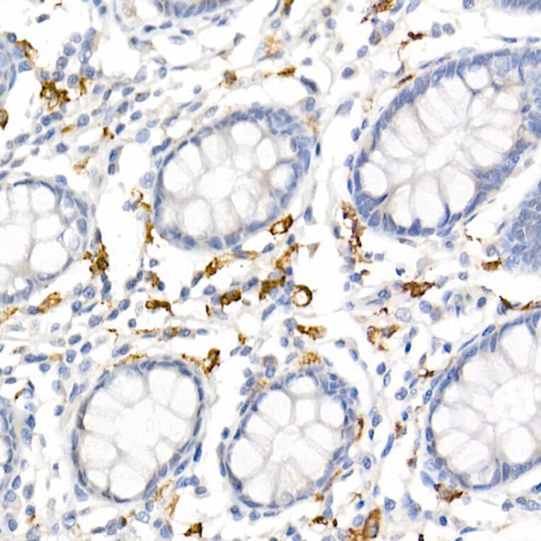 Immunohistochemistry - Anti-CD163 Antibody (A17078) - Antibodies.com