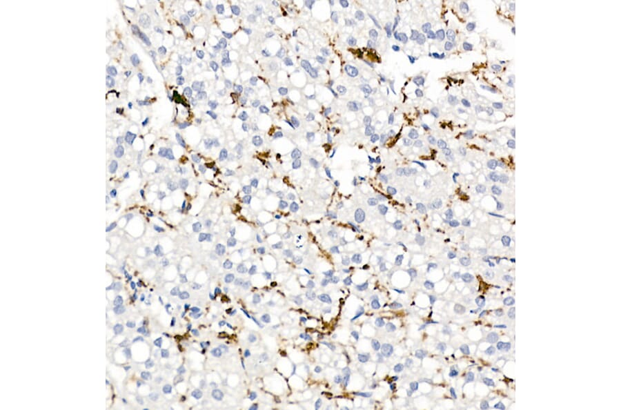 Immunohistochemistry - Anti-CD163 Antibody (A17078) - Antibodies.com