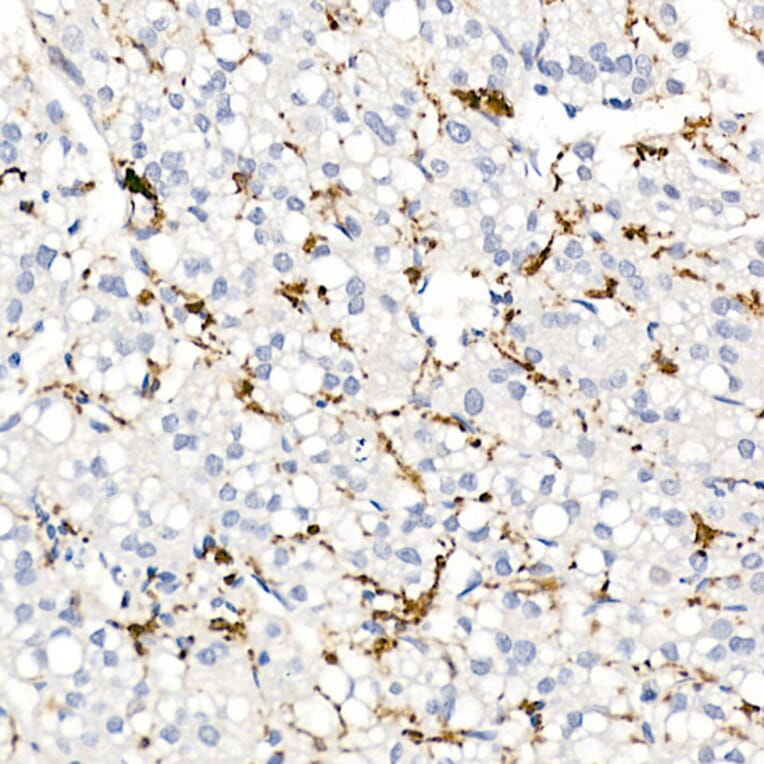 Immunohistochemistry - Anti-CD163 Antibody (A17078) - Antibodies.com