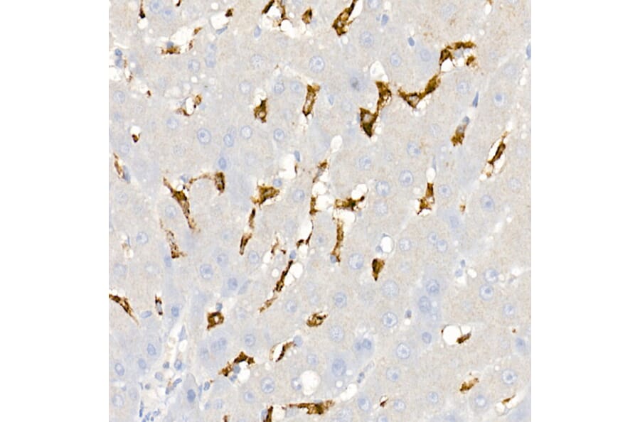 Immunohistochemistry - Anti-CD163 Antibody (A17078) - Antibodies.com