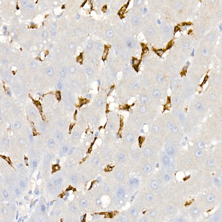 Immunohistochemistry - Anti-CD163 Antibody (A17078) - Antibodies.com