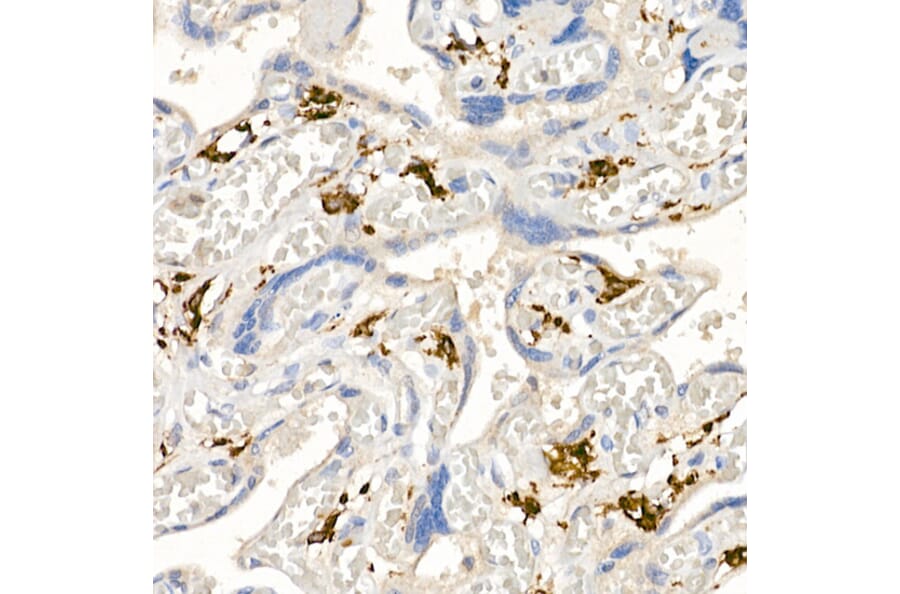 Immunohistochemistry - Anti-CD163 Antibody (A17078) - Antibodies.com