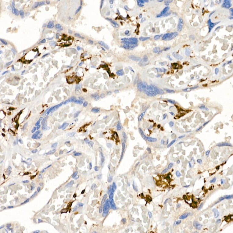 Immunohistochemistry - Anti-CD163 Antibody (A17078) - Antibodies.com