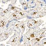 Immunohistochemistry - Anti-CD163 Antibody (A17078) - Antibodies.com