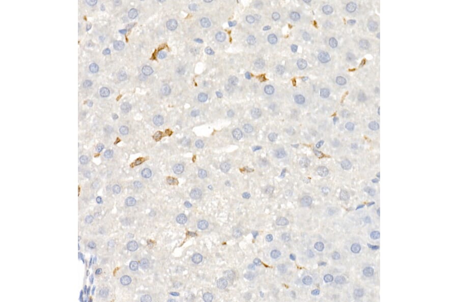 Immunohistochemistry - Anti-CD163 Antibody (A17078) - Antibodies.com