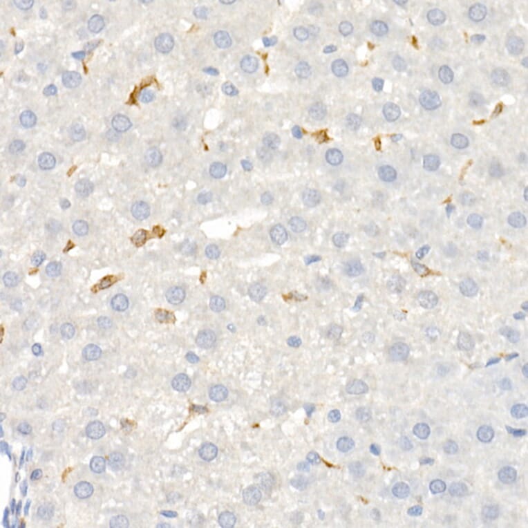 Immunohistochemistry - Anti-CD163 Antibody (A17078) - Antibodies.com