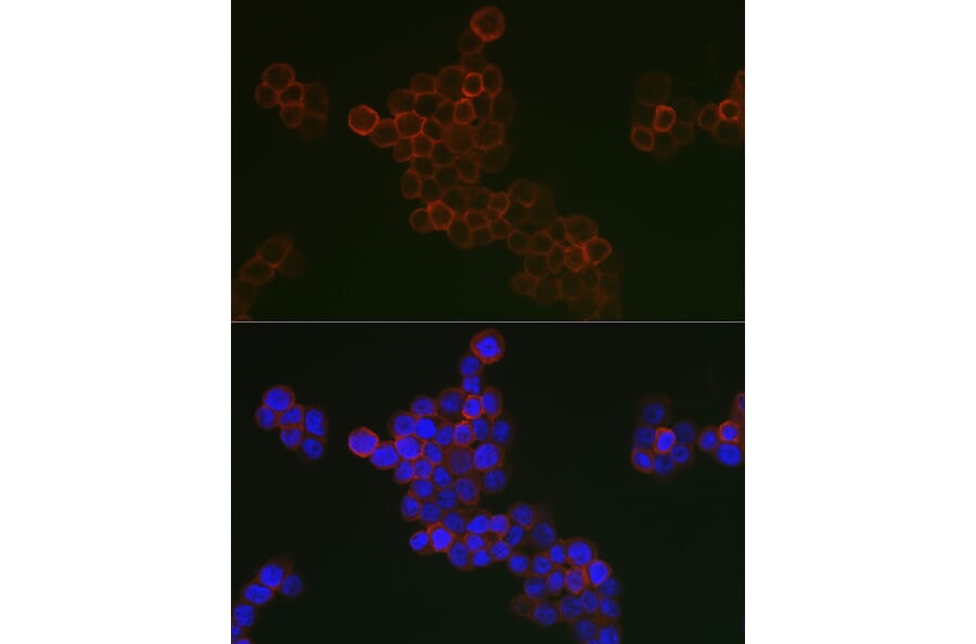 Immunofluorescence - Anti-CD163 Antibody (A17078) - Antibodies.com