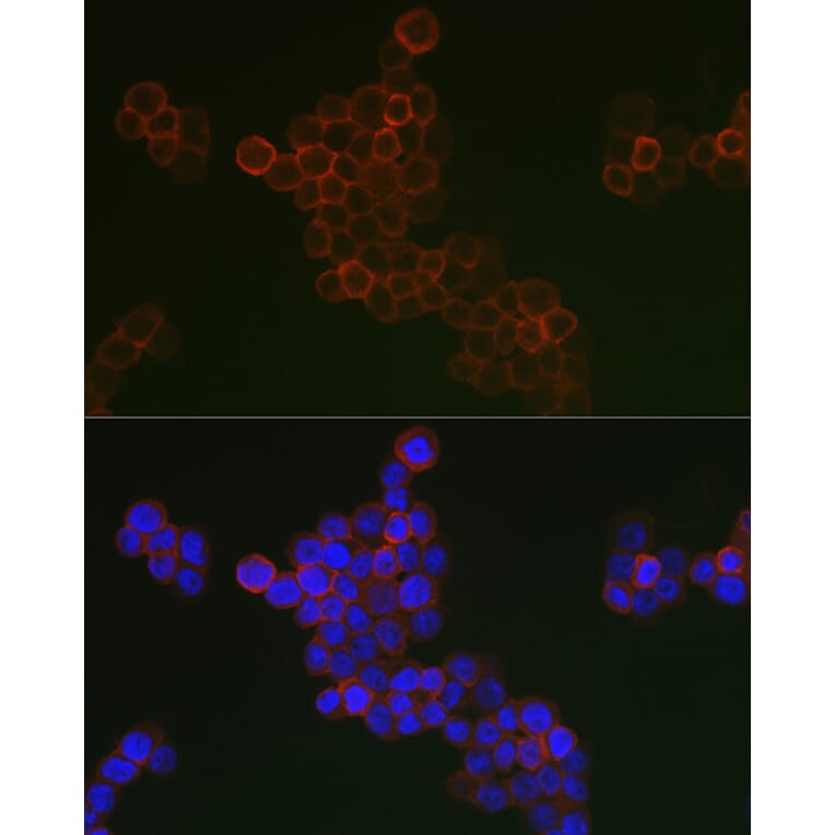 Immunofluorescence - Anti-CD163 Antibody (A17078) - Antibodies.com
